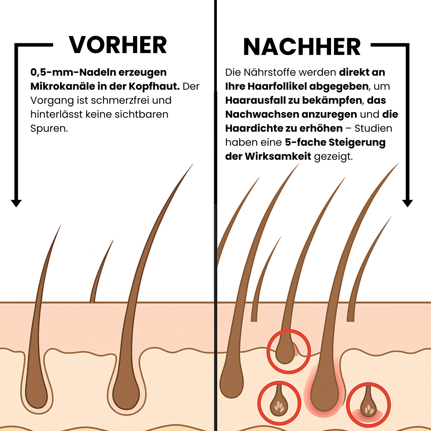 Peak Infuse Micro-Infusion Haarwuchs-System